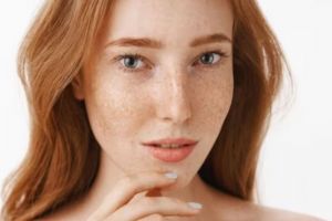 Tak perlu laser mahal, ini cara memudarkan flek hitam akibat hiperpigmentasi pakai 1 jenis daun herbal