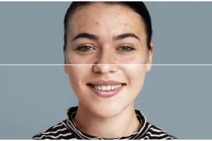 Tak ada lagi noda di wajah, ini trik hilangkan pigmentasi hanya pakai krim antiaging dari 1 jenis buah