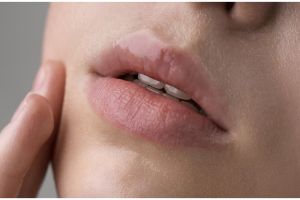 Trik atasi bibir kering akibat rokok pakai lip balm dari 1 jenis tanaman, bikin lembap dan merah alami