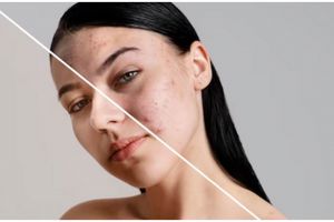 Tak ada lagi noda di wajah, begini cara simpel atasi flek dan bintik hitam hanya pakai 1 jenis buah