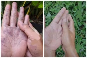 Cara mudah menghilangkan getah pisang di tangan, ampuh cuma pakai 2 bahan dapur