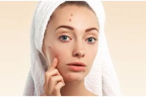 Bantu hempaskan jerawat meradang, begini cara membuat night serum hanya pakai 1 jenis herbal