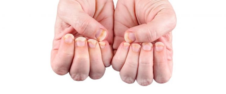 Tips Ampuh Menjaga Kekuatan Kuku agar Tetap Cantik dan Tahan Lama Tips Ampuh Menjaga Kekuatan Kuku agar Tetap Cantik dan Tahan Lama