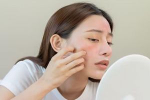 Cegah iritasi dan mengelupas, begini cara mengatasi kemerahan wajah pakai masker dari 1 jenis tepung