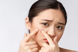 Bantu atasi jerawat meradang, ini trik merawat kulit sensitif pakai 1 jenis bahan minuman