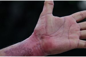 Cara pudarkan flek hitam di tangan dan kaki pakai body scrub dari 1 jenis rempah, bikin putih alami