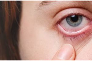 Nggak perlu beli eye serum roll, begini trik atasi mata sembab hanya pakai 1 bahan lalapan
