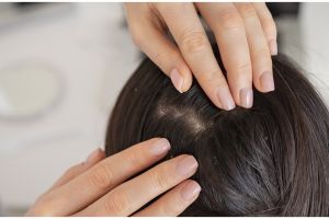 Cara atasi kebotakan akibat peradangan pakai masker dari 1 jenis rempah, bikin rambut kembali lebat