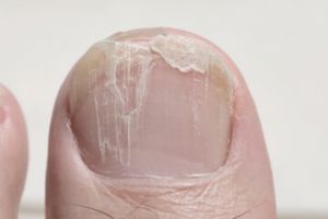 Cuma pakai gel dari 1 jenis daun, ini cara bikin kuku antirapuh dan nggak gampang patah