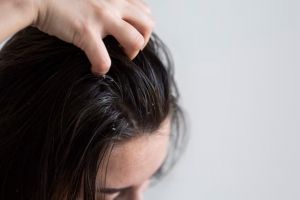 Trik atasi minyak berlebih di kepala pakai 2 jenis bahan makanan, usir rasa greasy di rambut