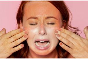 Hanya pakai 1 jenis minuman, ini cara atasi kulit terbakar akibat sinar matahari agar tak iritasi