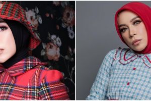 Parasnya kian tirus pasca operasi lambung, penampilan Melly Goeslaw ini disebut mirip Aming 