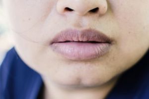 Cerah alami dalam 7 hari, ini trik antiribet pudarkan bibir gelap pakai 1 jenis kulit buah