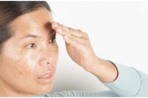 Wajah 10 tahun awet muda modal 5 ribu, ini cara hilangkan spot hitam pakai serum dari 2 jenis buah