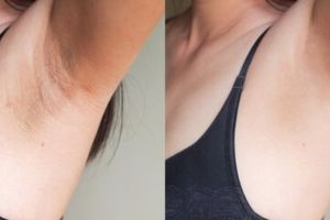 Mulus dan cerah bak model, ini trik memutihkan ketiak gelap pakai 1 bahan minuman