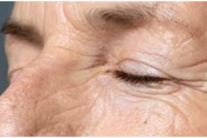 Kerutan hilang tanpa botoks, ini cara atasi penuaan pada kulit di usia 50 tahun pakai 1 jenis umbi