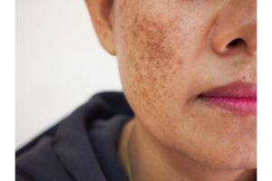 Bikin wajah kinclong merata, ini trik simpel pudarkan spot hitam dan kulit belang pakai 1 jenis buah