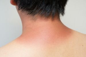 Trik simpel pudarkan kulit badan belang pakai 1 jenis tepung, auto cerah merata