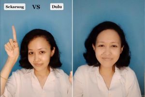 Wanita ini tunjukkan tampilan makeup-nya dulu vs sekarang, hasilnya kontras banget