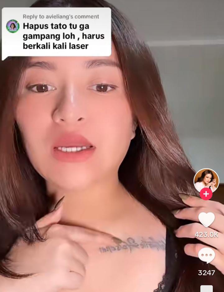7 Kali lakukan laser tak kunjung hilang, begini perjuangan Nathalie Holscher hapus tato di tubuhnya