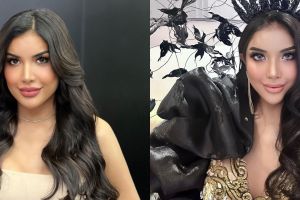 8 Potret terbaru Millen Cyrus usai operasi hidung, disebut mirip Ayu Azhari hingga Priyanka Chopra