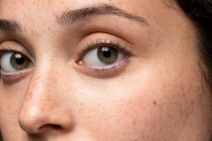 Bukan pakai tepung beras, begini cara mengatasi hiperpigmentasi pada wajah dengan 1 jenis rempah