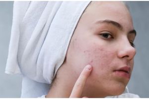Bukan dengan kunyit, ini cara samarkan garis halus dan flek hitam hanya pakai 1 jenis biji-bijian