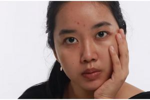 Bukan dengan kopi, ini trik cerahkan flek hitam akibat penggunaan produk skincare pakai 2 bahan alami