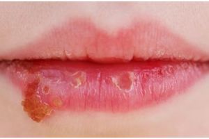 Tanpa gunakan madu, ini cara membuat lip gloss agar bibir tetap lembap hanya pakai 1 bahan alami