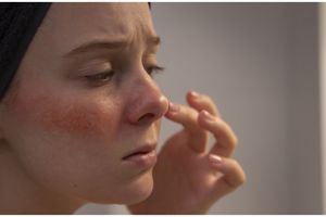 Tak perlu petroleum jelly, ini cara atasi kulit kering dan kusam hanya pakai 1 bahan pemanis