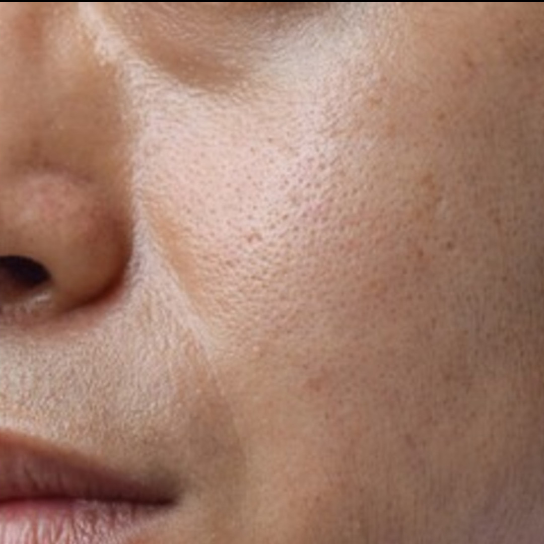 Nggak perlu kopi, ini cara bikin pori-pori mengecil agar kulit tampak mulus cuma pakai 1 kulit buah