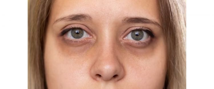 Cara Elak ‘Creasing’ Di Bawah Mata