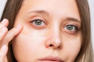 Tak pakai minyak zaitun, ini trik atasi dark circle dan kantung mata dengan 1 jenis bahan pemanis