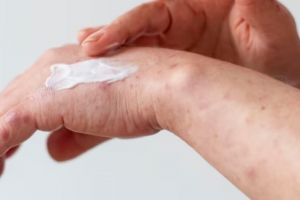 Tak perlu kopi, ini cara atasi bintik hitam dan sel kulit mati pada kulit pakai 1 jenis bahan kue