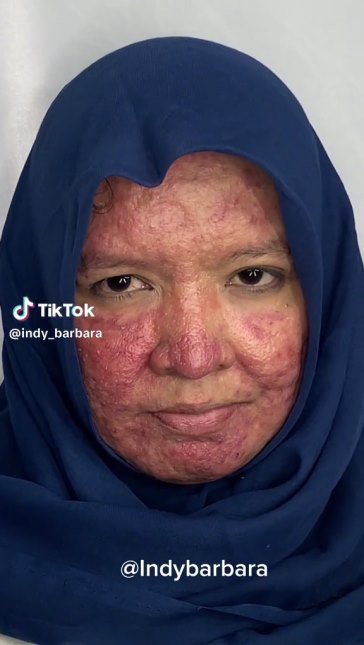 Muka bopeng efek gonta-ganti skincare, MUA ini sulap wajah pengantin Sunda jadi mulus dengan makeup