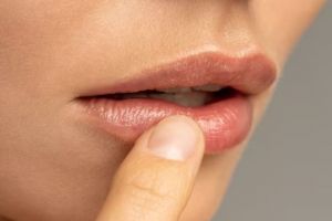 Tak perlu tambahan madu, begini trik atasi bibir mengelupas dan hitam pakai 1 produk pelembap