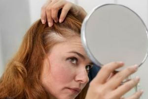 Bukan pakai bawang merah, ini trik tumbuhkan rambut pitak pakai masker dari 1 jenis produk olahan susu