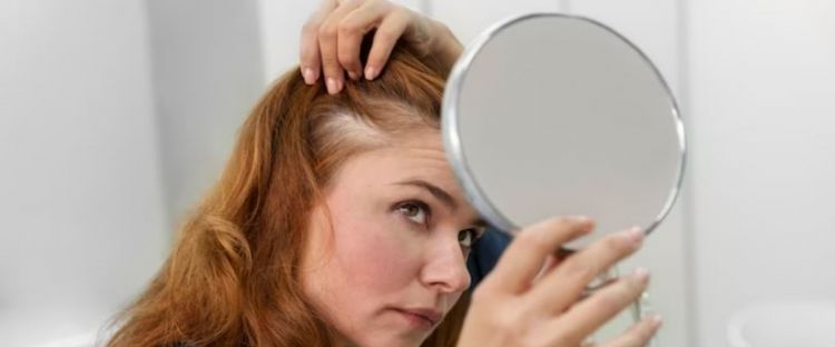 Bukan pakai bawang merah, ini trik tumbuhkan rambut pitak pakai masker dari 1 jenis produk olahan susu