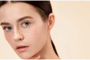 Bukan pakai krim pencerah, ini cara hilangkan flek hitam membandel di wajah hanya pakai 1 jenis bunga