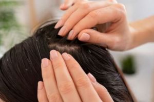 Tak perlu minyak zaitun, ini cara atasi kulit kepala kering dan berketombe pakai 1 jenis bumbu dapur