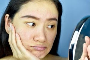 Tanpa timun maupun madu, ini trik bikin kulit bebas kering dan kusam pakai 1 jenis umbi-umbian