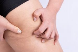 Tak perlu gula pasir, ini cara menyamarkan selulit membandel pakai body scrub dari 1 jenis minyak