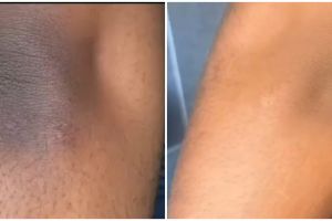 Bukan dengan kopi dan kunyit, ini cara memutihkan siku hitam pakai scrub dari 1 produk pembersih gigi