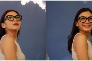 11 Penampilan gigi baru Chelsea Olivia, warganet heboh bandingkan penampilannya yang dulu 