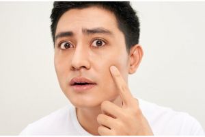Tak perlu beli skincare mahal, ini trik atasi keriput akibat perubahan cuaca hanya pakai 2 bahan alami