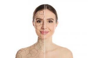 Nggak perlu air beras, ini trik lembapkan kulit kering kerontang pakai 1 sumber karbohidrat