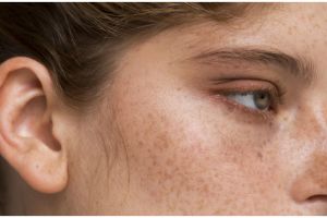 Tanpa perlu serum niacinamide, ini cara mudah hilangkan flek hitam pakai masker dari dua bahan alami