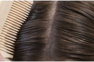 Tanpa buah pisang, ini trik atasi ketombe akibat penggunaan sampo tak cocok pakai 1 jenis biji-bijian