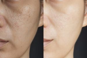 Tak perlu serum mahal, ini trik mudah bikin kulit cerah bersinar cuma pakai kulit 1 jenis buah