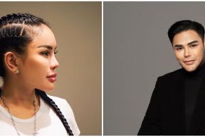 Biaya operasi hidung 5 seleb ini bikin nggak habis ‘fikri’, kantong kaum mendang-mending auto menjerit